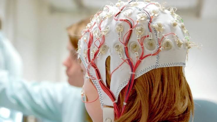 Neuropsychological Assessment In Epilepsy In Nagpur